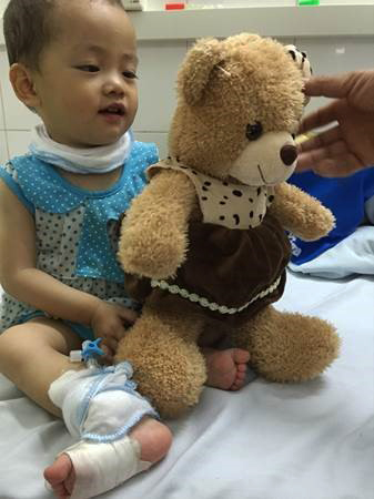 Toddler with leg bandage playing with teddy bear in hospital room